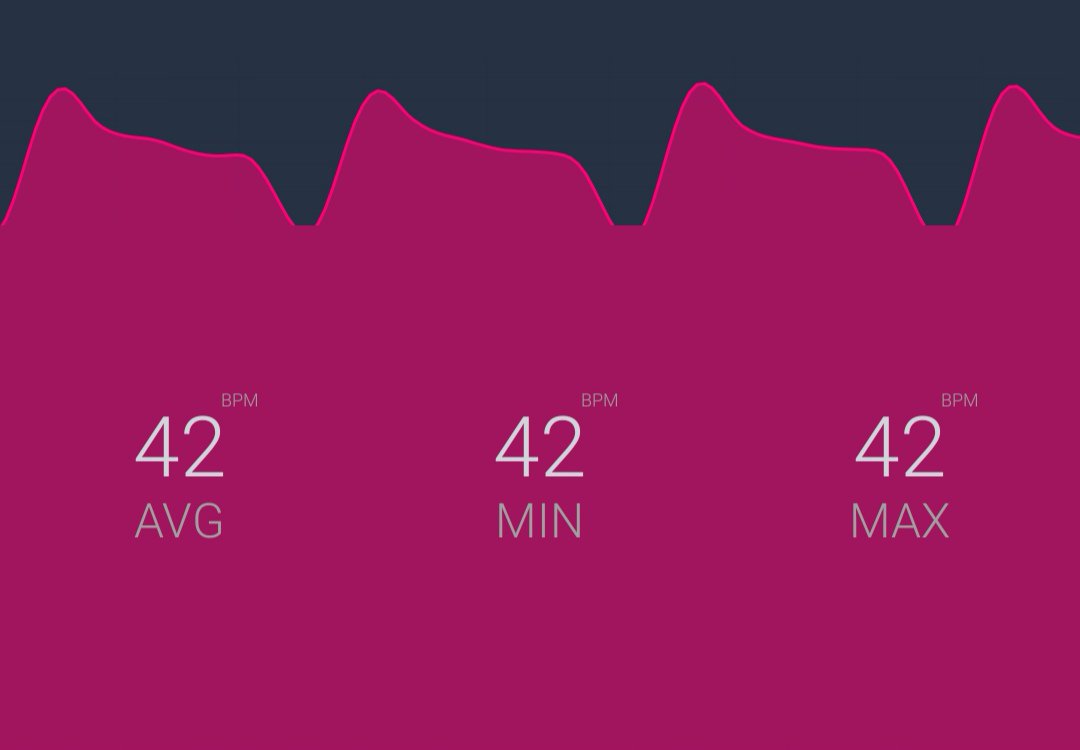 joncampling's tweet photo. This morning's resting heart rate.
π
Time for a run I think.
C u my insta from 10am
www.instagram/jon_campling
#live5k #runwithregis #5kEveryday https://t.co/zcVkrrb1UX