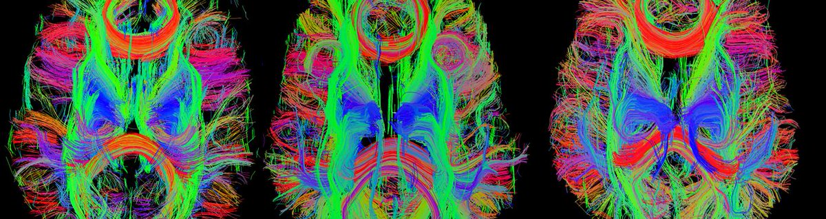 veronicapascboe's tweet image. Para crear #InteligenciaArtificial necesitamos entender nuestro #cerebro y para ello necesitamos avanzar en #IA 

ow.ly/Dv3I30l7nKr by @Ps_Digitales #AI #Emprendimiento #innovación