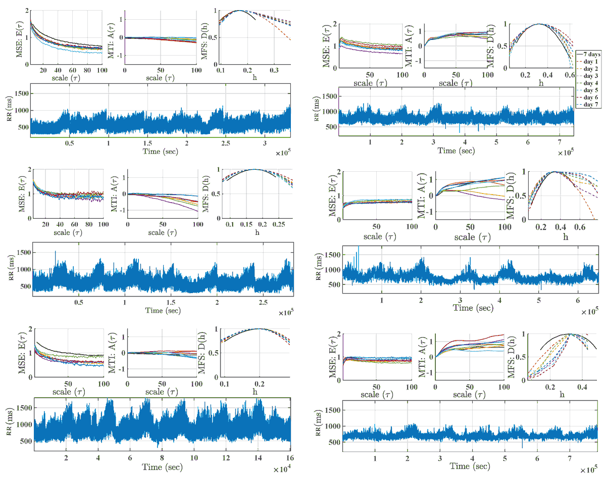 Entropy_MDPI's tweet photo. #mdpientropy On the Robustness of Multiscale Indices for Long-Term Monitoring in Cardiac Signals https://t.co/hvkXyhH9n3
#nonlineardynamics; multiscale indices; #cardiacriskstratification; #Holter; #longtermmonitoring; #multiscaleentropy; #multifractalspectrum https://t.co/ZgkkWyBStP