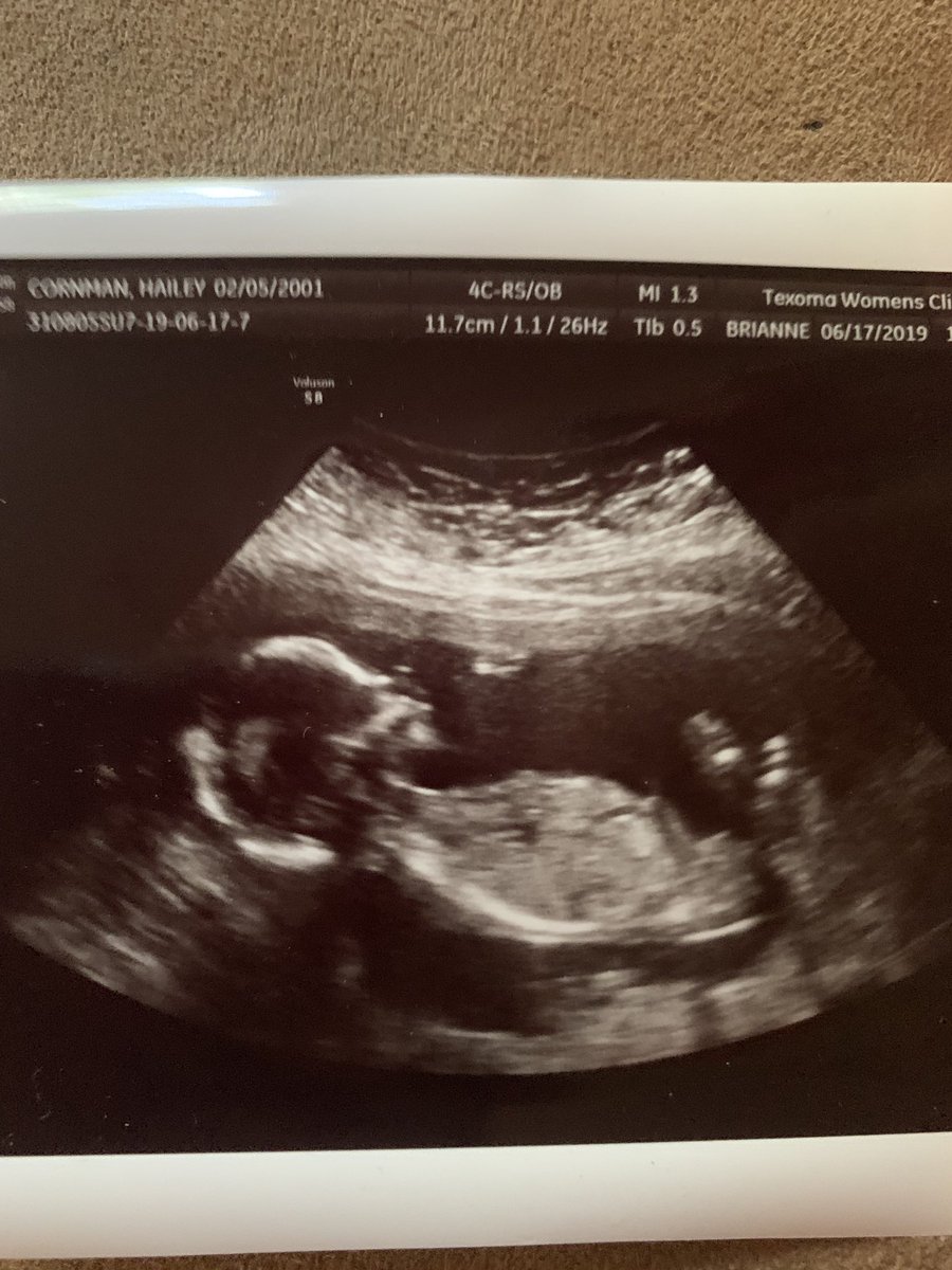 HaileyCornman's tweet photo. so excited to start this next chapter of life with you. it may not have been in order, but there’s no doubt in my mind that we won’t be great at this. i love you with my whole heart, and can’t wait to see what god has planned in our future!💕baby Williams coming December 3,2019! https://t.co/HcveNSGIE2