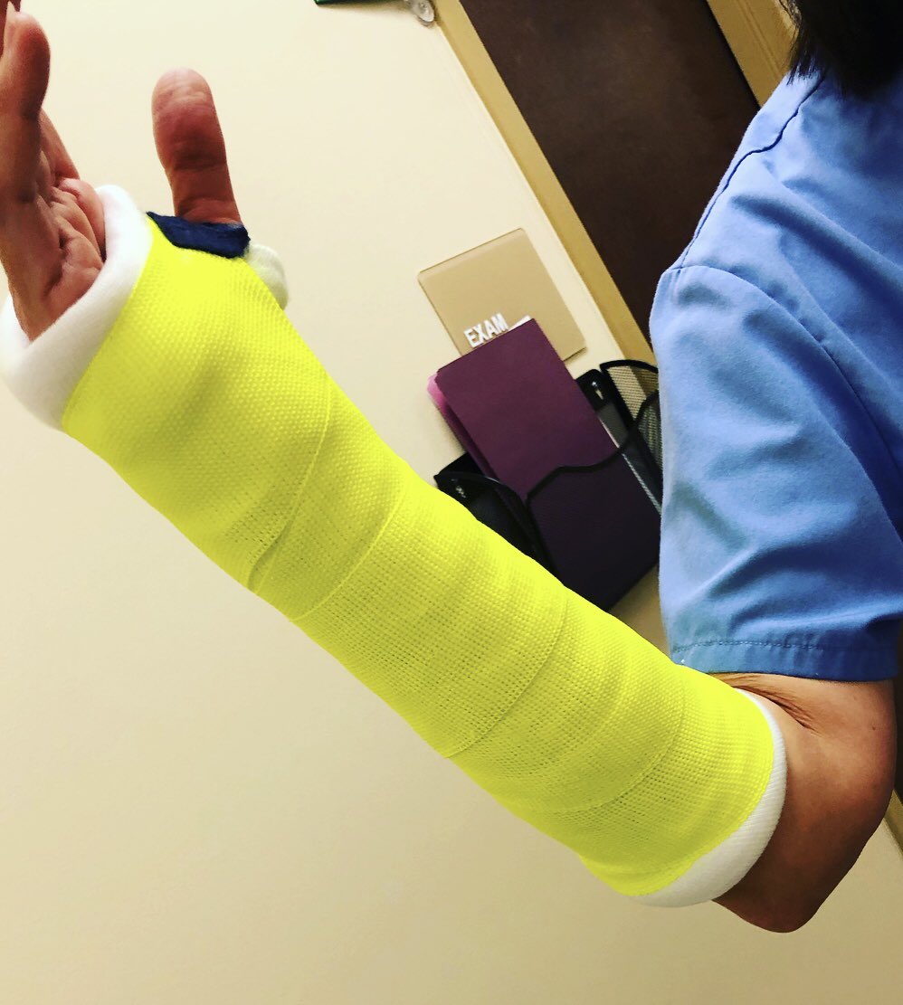 MrsJen_ATC's tweet photo. Got to learn some fun new skills at my new job ☺️ also if you ever need a cast you should totally ask for yellow this color was awesome #HumanHighlighter https://t.co/ovl4HKL3me