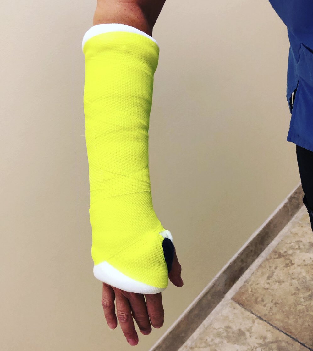 MrsJen_ATC's tweet photo. Got to learn some fun new skills at my new job ☺️ also if you ever need a cast you should totally ask for yellow this color was awesome #HumanHighlighter https://t.co/ovl4HKL3me
