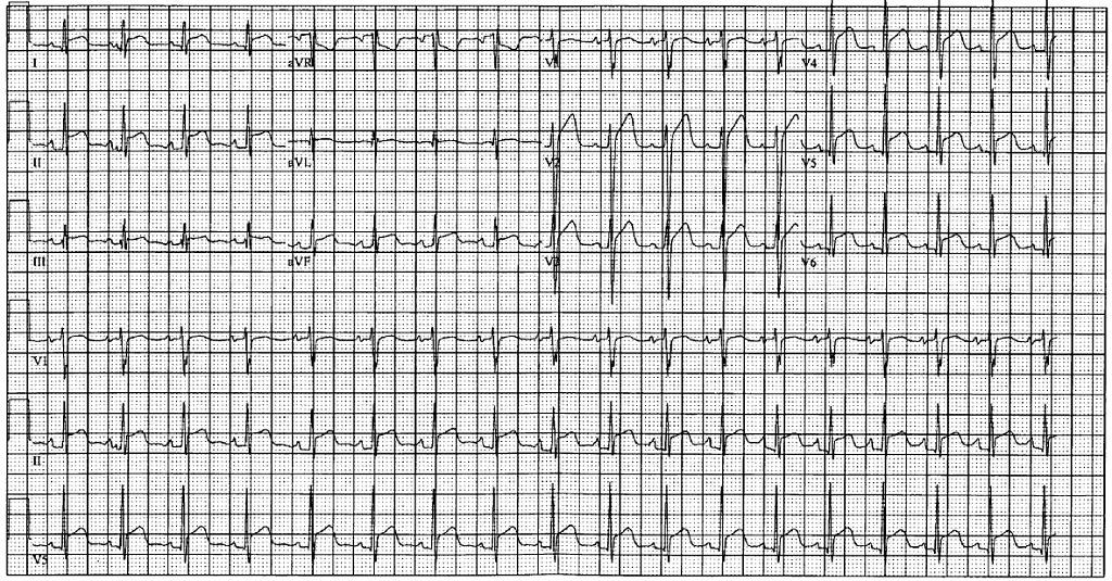 American College of Cardiology tweet media