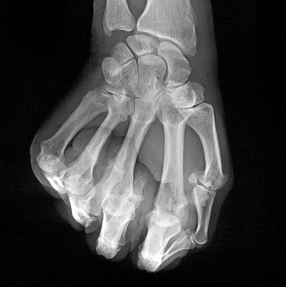 UNC Radiology Residency (@uncradres) on Twitter photo When people say the #CoreExam is just another test. Almost there R3s! #RadRes <a href="/jwallace1500/">Josh Wallace</a> <a href="/mcbreamy/">Peter Bream</a> <a href="/ABR_Radiology/">American Board of Radiology</a> <a href="/DavidMauroMD/">DavidMauroMD</a> When people say the #CoreExam is just another test. Almost there R3s! #RadRes <a href="/jwallace1500/">Josh Wallace</a> <a href="/mcbreamy/">Peter Bream</a> <a href="/ABR_Radiology/">American Board of Radiology</a> <a href="/DavidMauroMD/">DavidMauroMD</a>