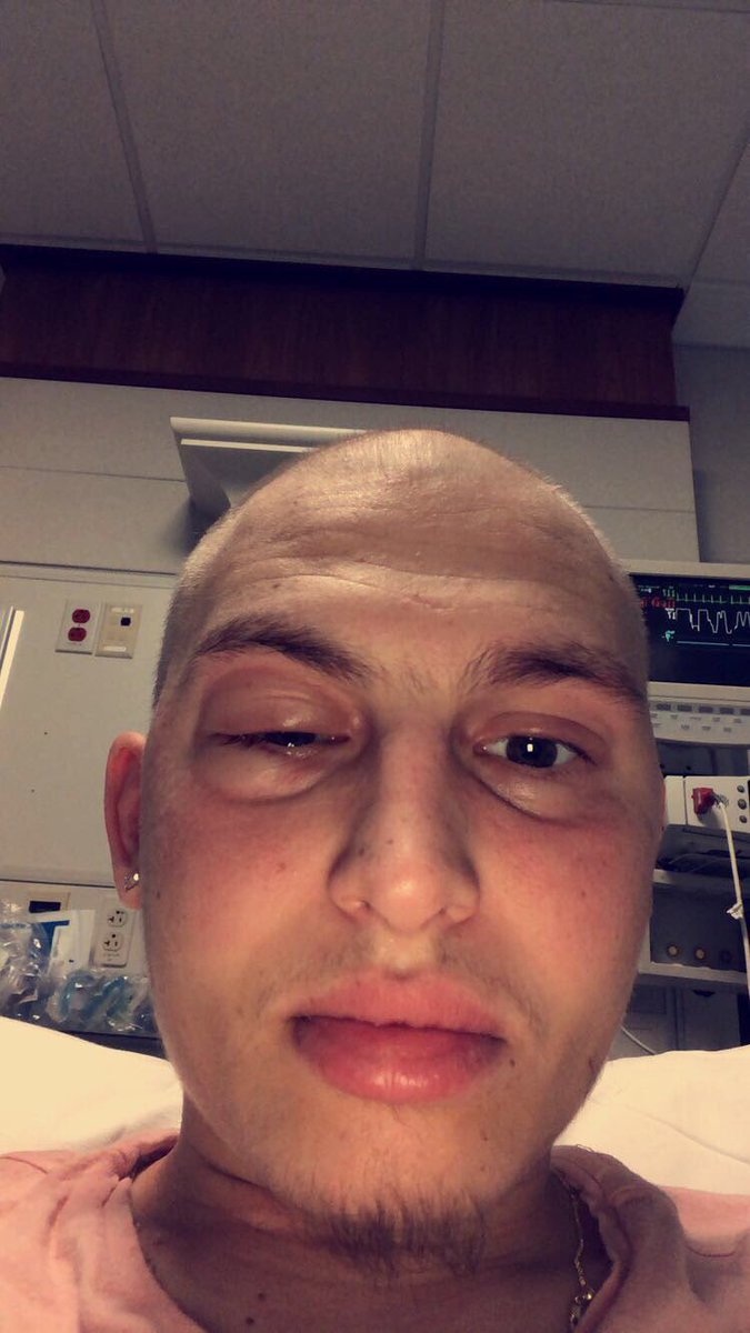 SHIFTERZZ2317's tweet photo. Exactly one year ago today my life changed drastically I have been thru some fucked up shit this past year but this shit will NOT stop me from beating this cancer. I’m so happy that I’m still here breathing and being myself 2 more years to go and we done🛎💪🏽 #fuckcancer https://t.co/yGeYoqQrJC