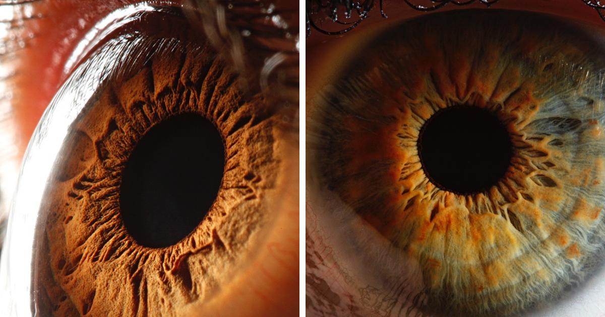 danoedmund's tweet photo. 14 Fascinating Close-Ups Of The Human Eye That Will Mesmerize You https://t.co/9dYN8tHtcY #Photography #closeupeye via @sliptalking https://t.co/XKnhq56gdl