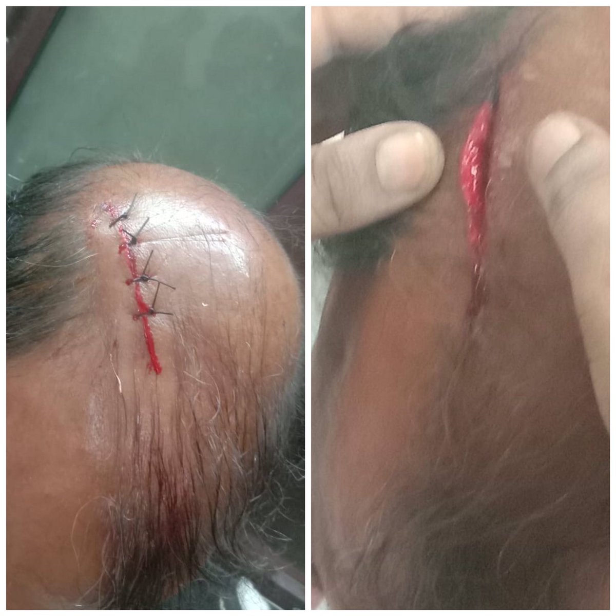 samwalker_0207's tweet photo. This is what happened to that policemen whom nobody seemed to be bothered about https://t.co/jCAycr0ZeI