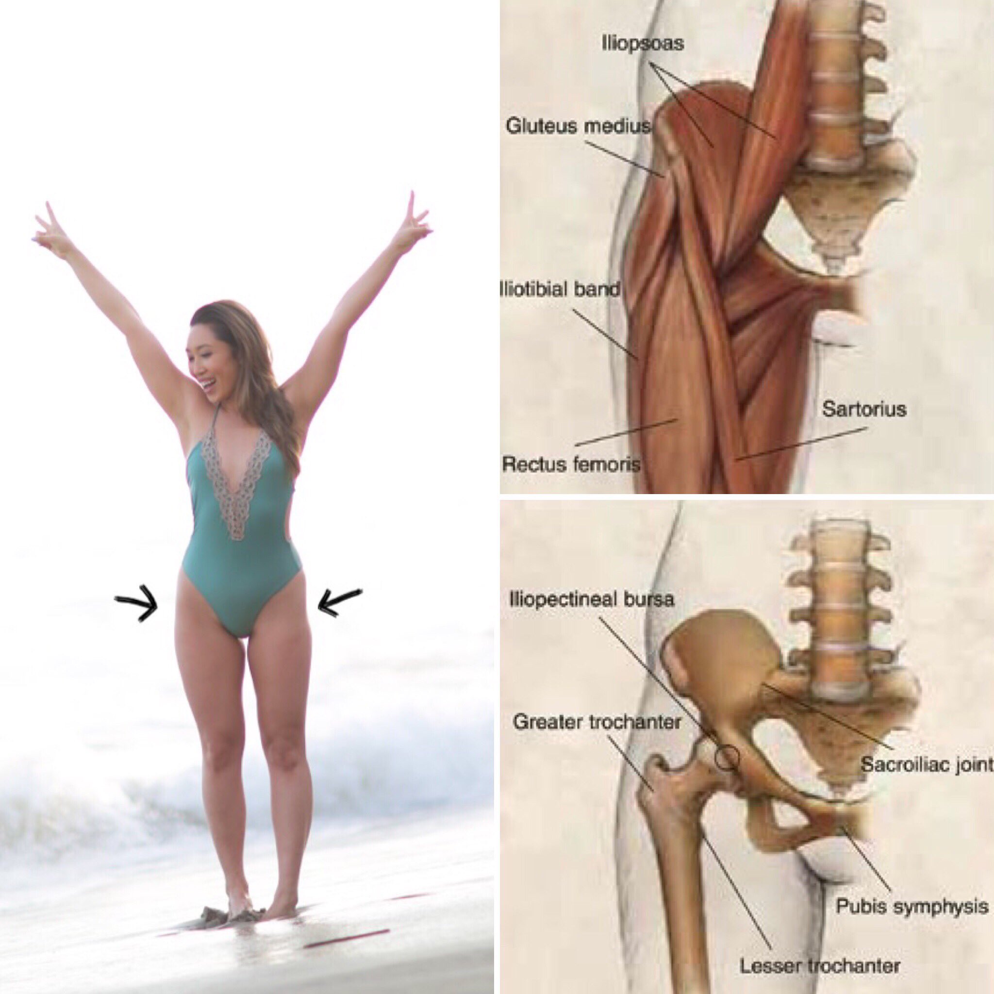 Hip Dips