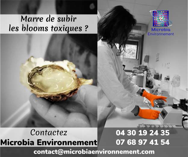 MicrobiaE's tweet photo. C'est la saison touristique, anticipez les proliférations de micro-algues toxiques. Contactez-nous! https://t.co/NwpZeTIBYL