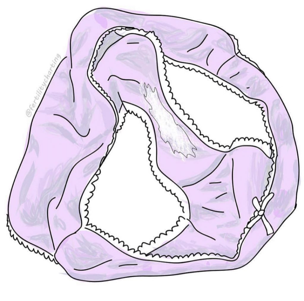 ohmyyoni's tweet photo. Vaginal discharge is fluid that contains a mix of vaginal secretions and cervical mucus. The amount of discharge produced varies from woman to woman.

vaginal discharge helps keep the vagina clean, provides lubrication during sexual intercourse, and may help prevent infection. https://t.co/gO8SvyIl5l