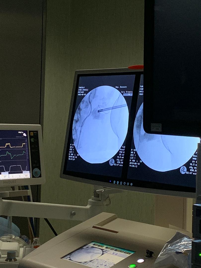 👉🏼Secondo appuntamento con I-stone, per parlare di #endourologia e #calcolosiurinaria
📍Ospedale San Bassiano, a Bassano del Grappa (VI)
🔸Oggi prima giornata di formazione dedicata alla #RIRS 
➡️Letture e hands on e live surgery con <a href="/PusenMedical/">Pusen Medical</a> e ClearPetra <a href="/JustineShi_js/">@ClearPetra-Well Lead</a>