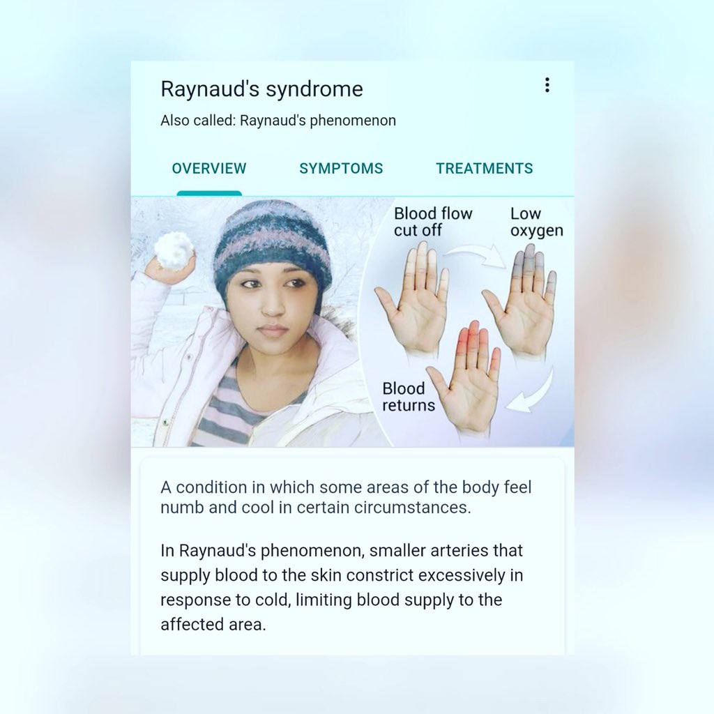 FarahKhaleck's tweet image. This weather is a nightmare for Sclero symptoms, esp Raynauds Syndrome or as I would say blue fingers.
My fingers used to go numb, l couldn’t feel them, couldn’t hold anything. I had to constantly sit with a hot water bottle. Alhamdulillah 
#KnowScleroderma #SclerodermaAwareness
