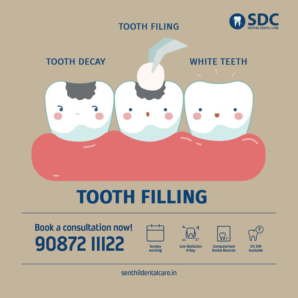 senthildental's tweet photo. #Tooth #Fillings #Treatment
Book an Appointment Online Now
Visit : https://t.co/8n3alfWfyC
Call us : +919087211122 https://t.co/OsBopElztY