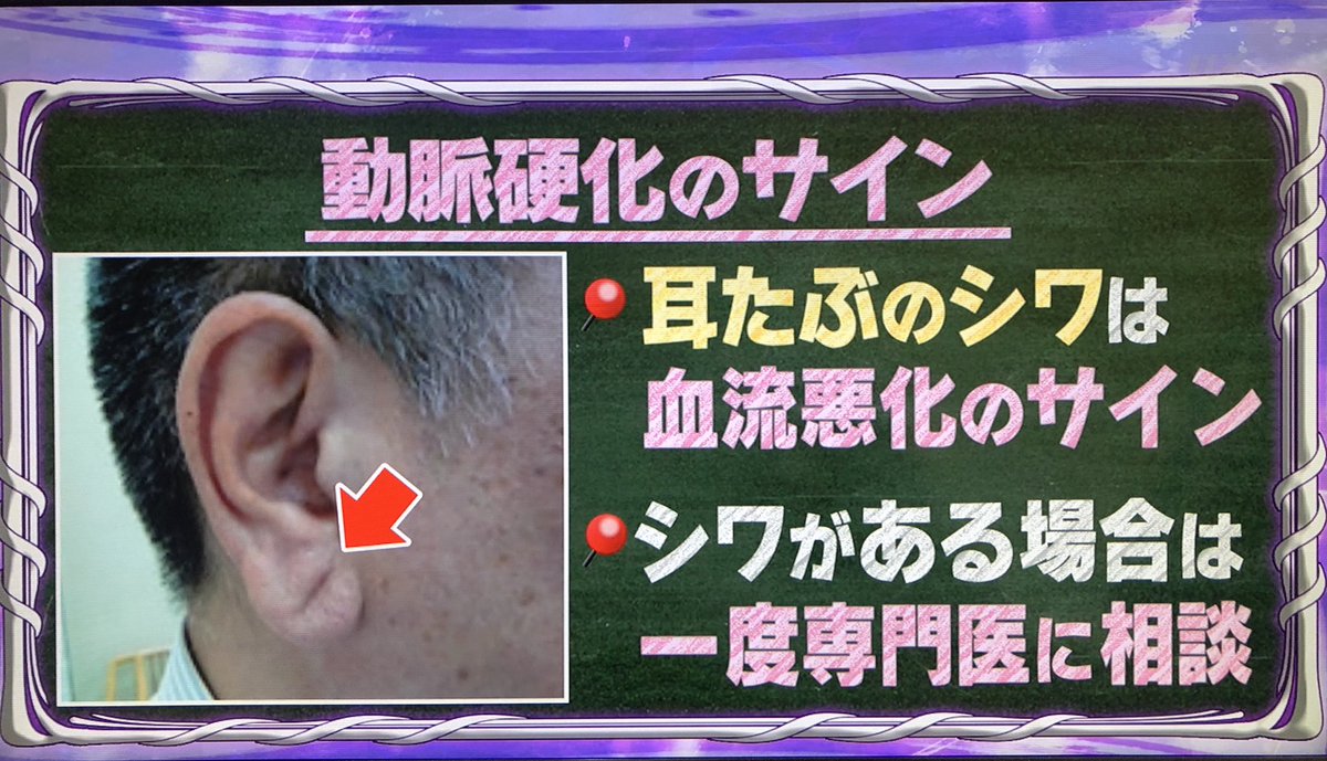 わっしょい第2 0章 Twitterren 耳たぶにシワがあるってスゴいな と思ったら あったw 心臓病リスク3倍てマジかよ 耳にできたシワは1度できたら治らないらしい 林修 林修の今でしょ講座