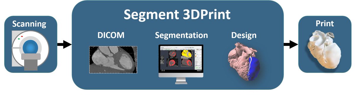 medviso's tweet photo. With #Segment3DPrint it is easy to go from DICOM image to #3Dprinted model.
#3dprint #research #clinicsolution https://t.co/EAh5FsSY7y
