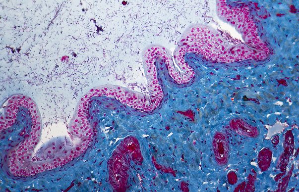 Oncology Times (@oncologytimes) on Twitter photo Precision Medicine in #BladderCancer: Updates from Dr. Dan Theodorescu of <a href="/CedarsSinai/">Cedars-Sinai</a> and Dr. Florus C. de Jong & Dr. Tahlita C.M. Zuiverloon of <a href="/ErasmusMC/">Erasmus MC</a> ow.ly/8gCu50uytgm #cancerawareness Precision Medicine in #BladderCancer: Updates from Dr. Dan Theodorescu of <a href="/CedarsSinai/">Cedars-Sinai</a> and Dr. Florus C. de Jong & Dr. Tahlita C.M. Zuiverloon of <a href="/ErasmusMC/">Erasmus MC</a> ow.ly/8gCu50uytgm #cancerawareness