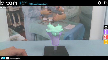 Cette semaine, <a href="/IRT_BCom/">b-com</a> présente <a href="/CARS2019Rennes/">CARS2019</a> une application de réalité augmentée en chirurgie orthopédique réalisée dans le cadre du projet <a href="/FollowKnee/">followKnee</a> via <a href="/DSIH_esante/">DSIH</a> buff.ly/2L1O8ws #RA #eSanté #orthopédie