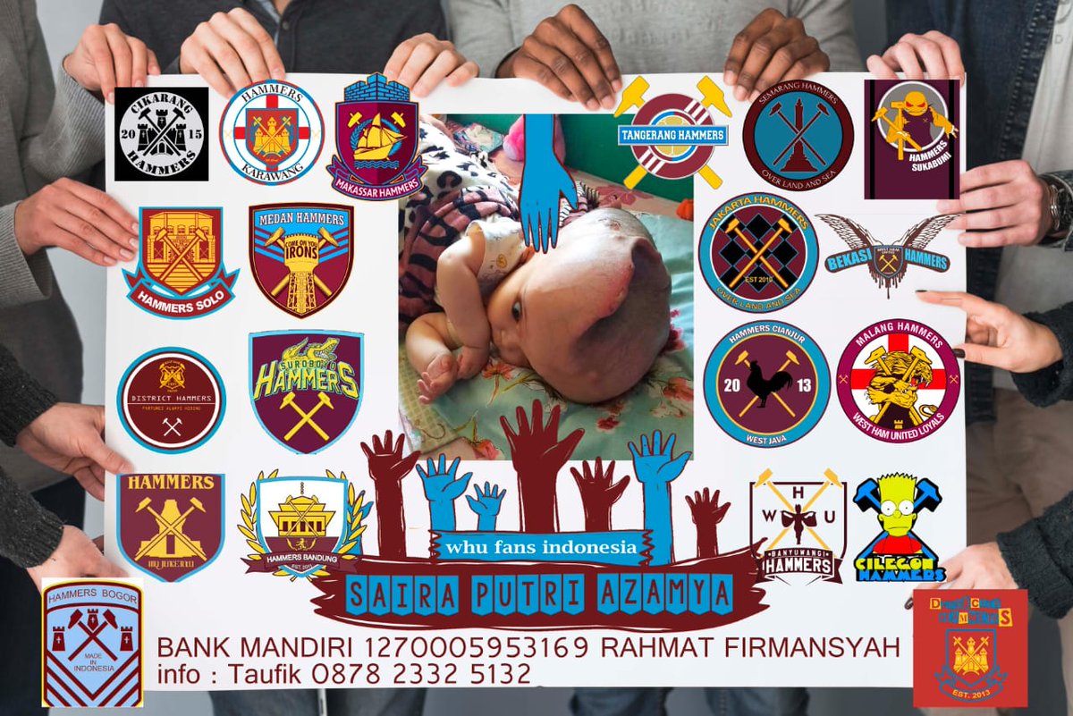 menekan otak dan dapat menyebabkan kerusakan otak. Kondisi ini paling sering terjadi pada bayi dan orang berusia lanjut.
Orang tua dari Saira merupakan buruh serabutan. Untuk donasi silahkan hubungi Taufik 087823325132