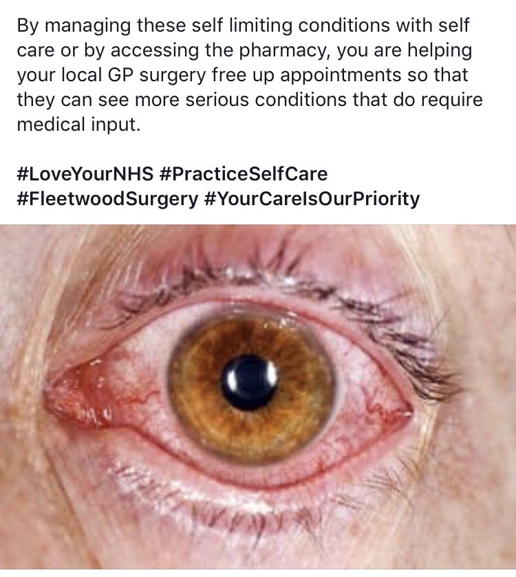 FleetwoodGP's tweet photo. Conjunctivitis is usually a self limiting condition. For more information visit https://t.co/7WvAZKnS0A https://t.co/T12FT2Y0h6