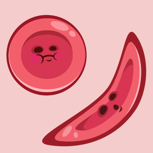 thrustinc's tweet photo. Red blood cells are usually disk-shaped, but #SickleCellDisease causes these cells to be crescent, or sickle, shaped. These cells can stick to vessel walls, causing blockages that prevent oxygen from reaching nearby tissues. #WorldSickleCellDay #DiseaseLiteracy #Hemonauts https://t.co/580HYH3mxr
