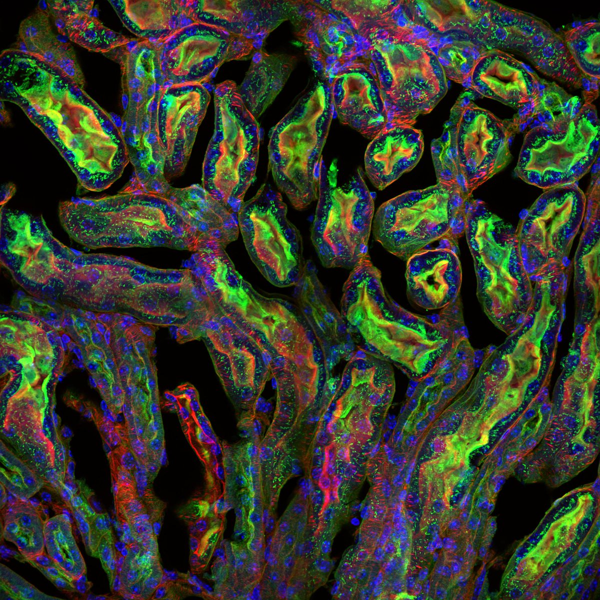 Evident_LS's tweet image. Check out these #micrographs of a mouse kidney section captured on the SpinSR super resolution microscope.