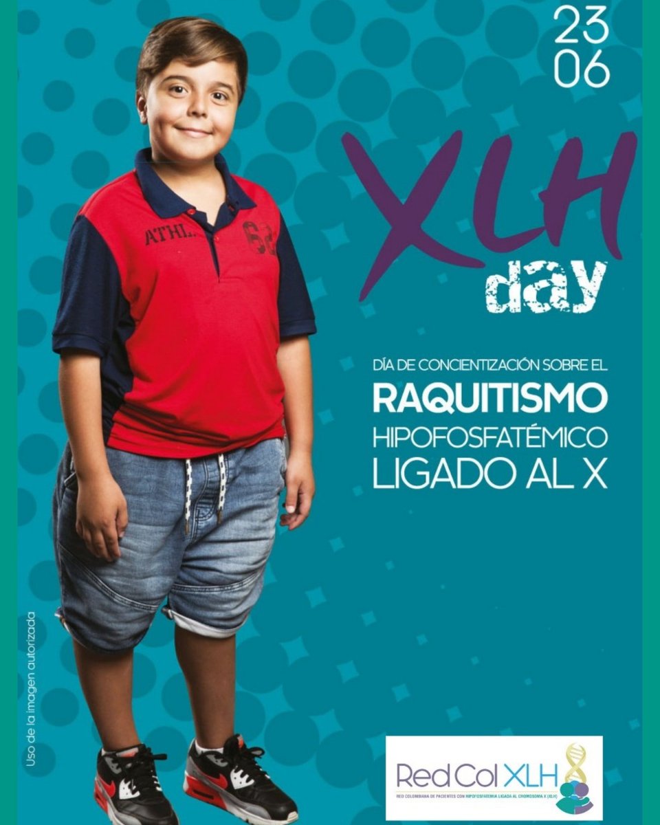 acopelcomunica's tweet photo. Sabes que és XLH ⁉ El raquitismo hipofosfatémico ligado al cromosoma X (XLH), es una enfermedad hereditaria, progresiva y crónica, que puede afectar niños y adultos. Es una enfermedad rara, que afecta 1 de cada 20.000 a 1 de cada 25.000 personas.
#RedColXLH #XLHDay https://t.co/sz8rheWn2J