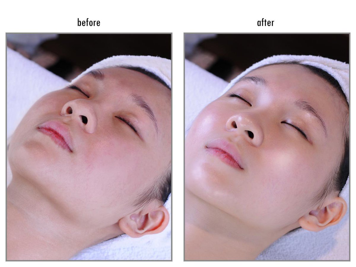 Intenseplus123's tweet image. Before &amp;amp; After 
Double Oxy-Jet Elixir Treatment

Find a professional salon near you with our intensive treatment products.
[ location ] intenseplus.com/location/