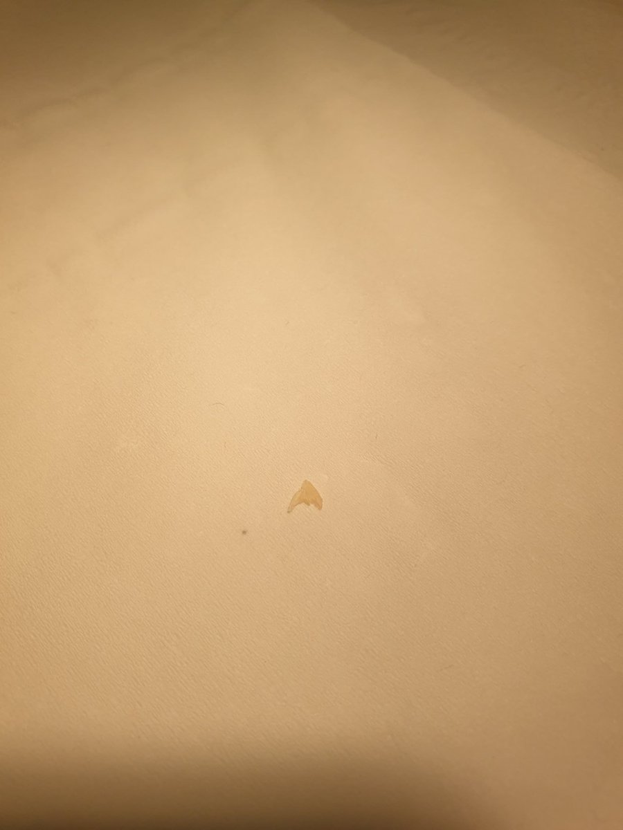 Ablefeet's tweet photo. One very happy 88yo gentleman this morning to be rid of his "sharks tooth", hobbled in, skipped out #podiatry #ingrowingtoenail #onychocryptosis https://t.co/jioWl2CeNO