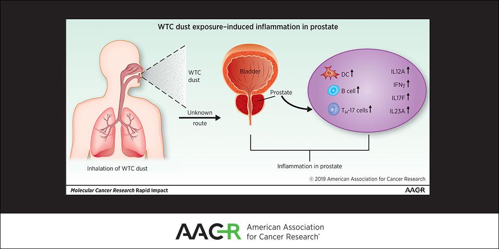AACR's tweet photo. RT @MCR_AACR: Just published #OnlineFirst: Inflammation from World Trade Center dust linked to #prostatecancer in #911firstresponders. #911health #publichealth
https://t.co/TaoCywbyuf https://t.co/1tefxHs5kT
