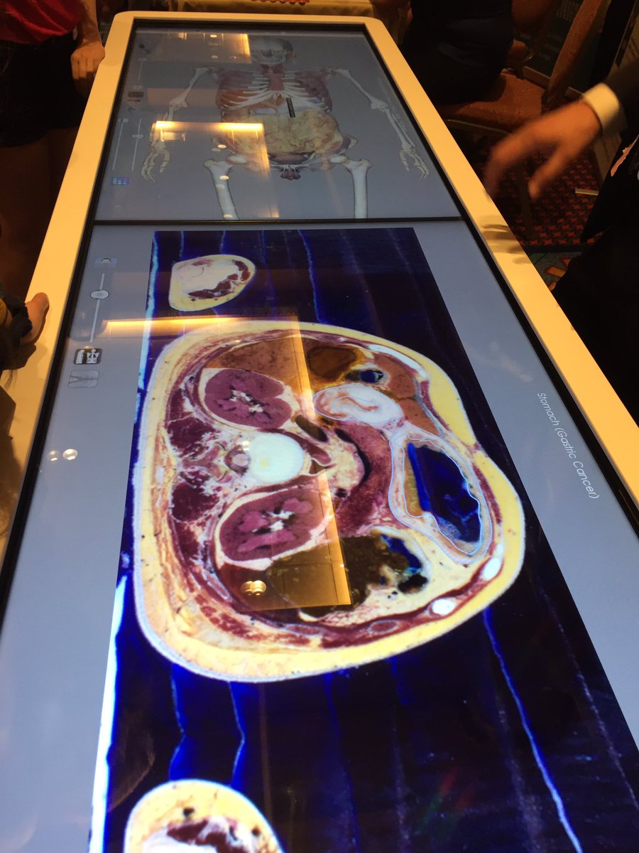 HosaMandan's tweet image. What a great table at the HOSA Expo. Get to see the different portions and views of the human body. #anatomagetable