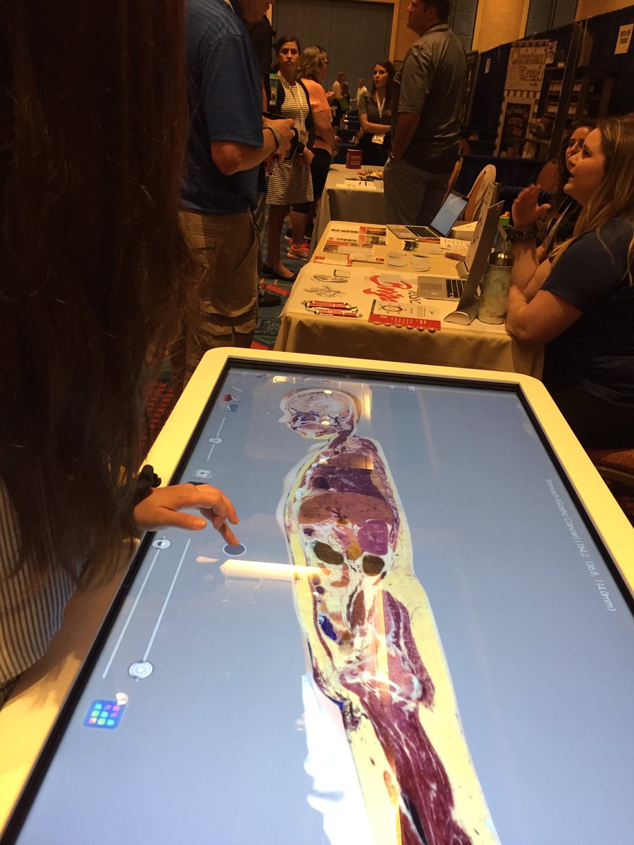 HosaMandan's tweet image. What a great table at the HOSA Expo. Get to see the different portions and views of the human body. #anatomagetable
