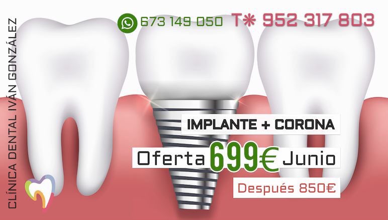 dr_ivangonzalez's tweet photo. ÚLTIMOS DÍAS ⎜ #Oferta de Implante+Corona 699€❋, tratamiento implantoprotésico completo, incluidas radiografías, por tiempo limitado

¡Solo hasta el 30 DE JUNIO! Envía mensaje de WhatsApp para reservar tu cita: 673 149 050

❋Regeneración Ósea Guiada (ROG) no incluida
#Málaga https://t.co/ZiyRf4s2p2