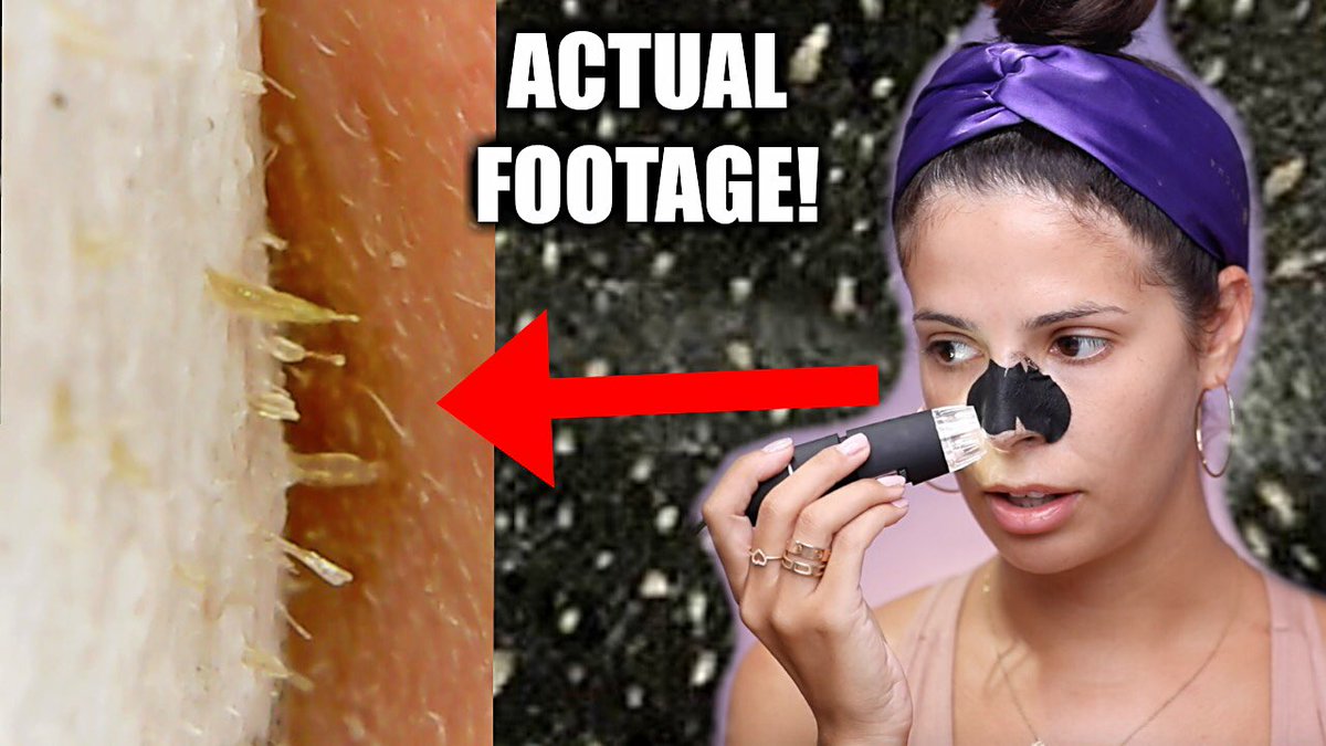 Blackheads Microscope