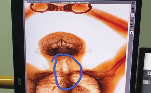 ATSecurityInc1's tweet photo. Body Scan is designed to used a low dose of radiation, checking for illegal objects such as: explosives, mobile phones, knives, guns, drugs, metals and wires.
Pictures below show some Body Scan discoveries at local jails. https://t.co/R6zDUFfq8T