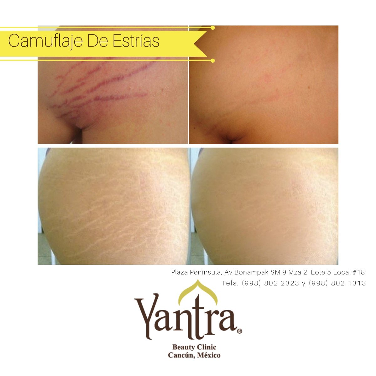 AGENDA TU CITA PARA REALIZARTE CAMUFLAJE DE ESTRÍAS ‼️

☎ Agenda tu cita al 802 2323
📍 Estamos en Av. Bonampak, Plaza Península de lunes a viernes de 9AM a 9PM y sábados de 9AM a 3PM