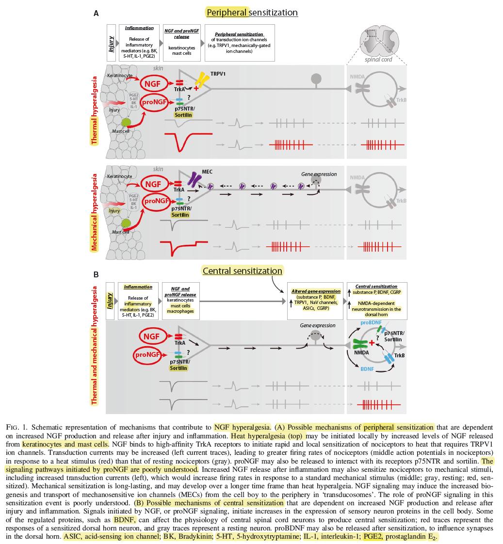 westr's tweet photo. One step closer to #chronicpain relief: "#Sortilin gates #neurotensin and #BDNF signaling to control peripheral #neuropathicpain"
https://t.co/PF4keHC13O via @aarhusuni @EurekAlert @ScienceAdvances https://t.co/4HfF9dMm8Y …
Sortilin KO mice are pain-free despite nerve damage. https://t.co/DxvOFrWhzk
