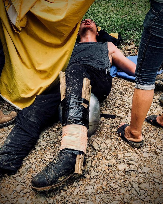 Andrea Vaccari (@vccr) on Twitter photo Last year today, I was coming out of surgery after having too much fun in Vietnam. Today, I'm flying to Canada to go on a long backpacking excursion with <a href="/dinglegreg/">Greg Dingle</a>. It's been a long journey to recovery, and I'm so ready for adventure! 💪 instagram.com/p/By8fIwgHiBq/ Last year today, I was coming out of surgery after having too much fun in Vietnam. Today, I'm flying to Canada to go on a long backpacking excursion with <a href="/dinglegreg/">Greg Dingle</a>. It's been a long journey to recovery, and I'm so ready for adventure! 💪 instagram.com/p/By8fIwgHiBq/