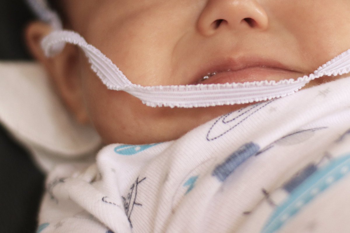 ユリマタタ Ar Twitter 帽子のゴムをビヨーンするのが好きな7ヶ月の息子 ずっとご機嫌にビヨンビヨンしてたけどついにバチンしたw への字口たまらん