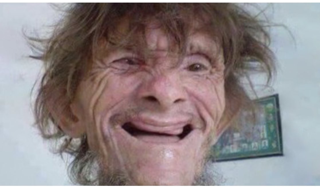 lifeandmorelife's tweet image. #coldman troll azz in 10 yrs time: