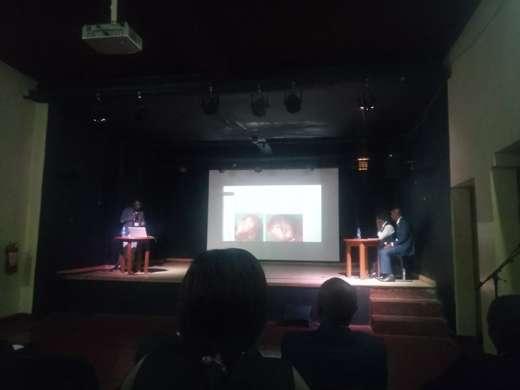 SteveBzl8's tweet photo. #Cyclopia (also cyclocephaly or synophthalmia) a rare congenital desease 
Dr Paterne Safari #neurosurgeon from DRC having a speech on 2clinical cases report founded in the east part of #DRC
@ulricksidney @clairekarekezi @InciSioNGlobal @ADN_Nyalundja @Davidmasheka1 https://t.co/p273pOAZtw