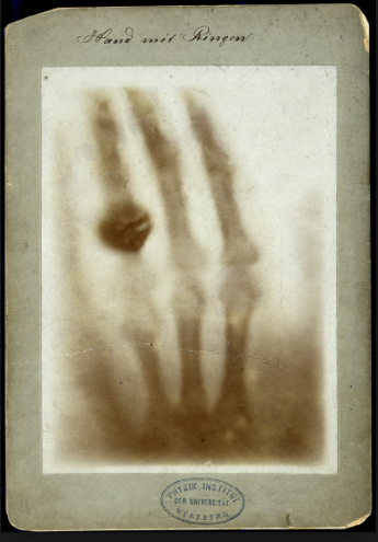 makingofsense's tweet photo. The first X-ray image, “Hand With Ring” by Wilhelm Conrad Roentgen, 1895. https://t.co/BVzMUEB52m
