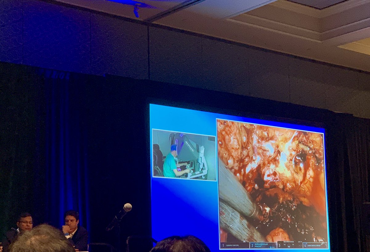 chiaridelprete's tweet photo. Now: #roccostitch during #RARC with #neobladder by Dr. Peter Wiklund @socroboticsurg @ERUSrobotics @bernardorocco73 @MariaChiaraMCS https://t.co/U6ubPjWqEQ