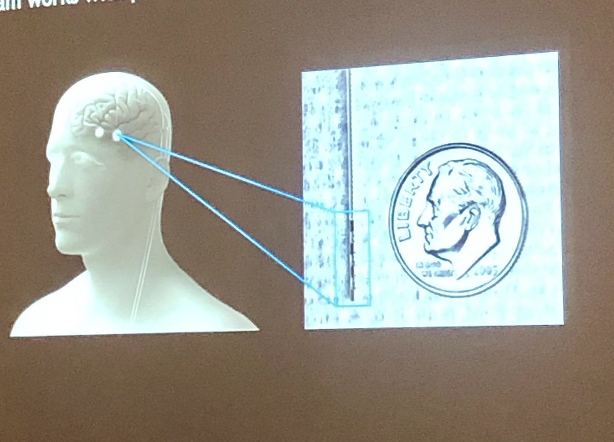 LizHellerMurray's tweet image. A to-scale representation of a #DBS  device from Dr. Mark Richardson 

Welcome to Boston @RMarkRichardson! #2019BSMCS