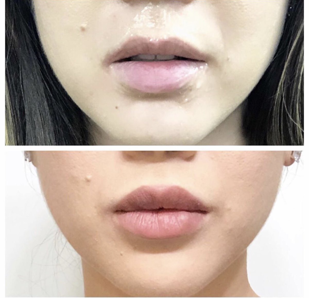 advanced skin care & laser center