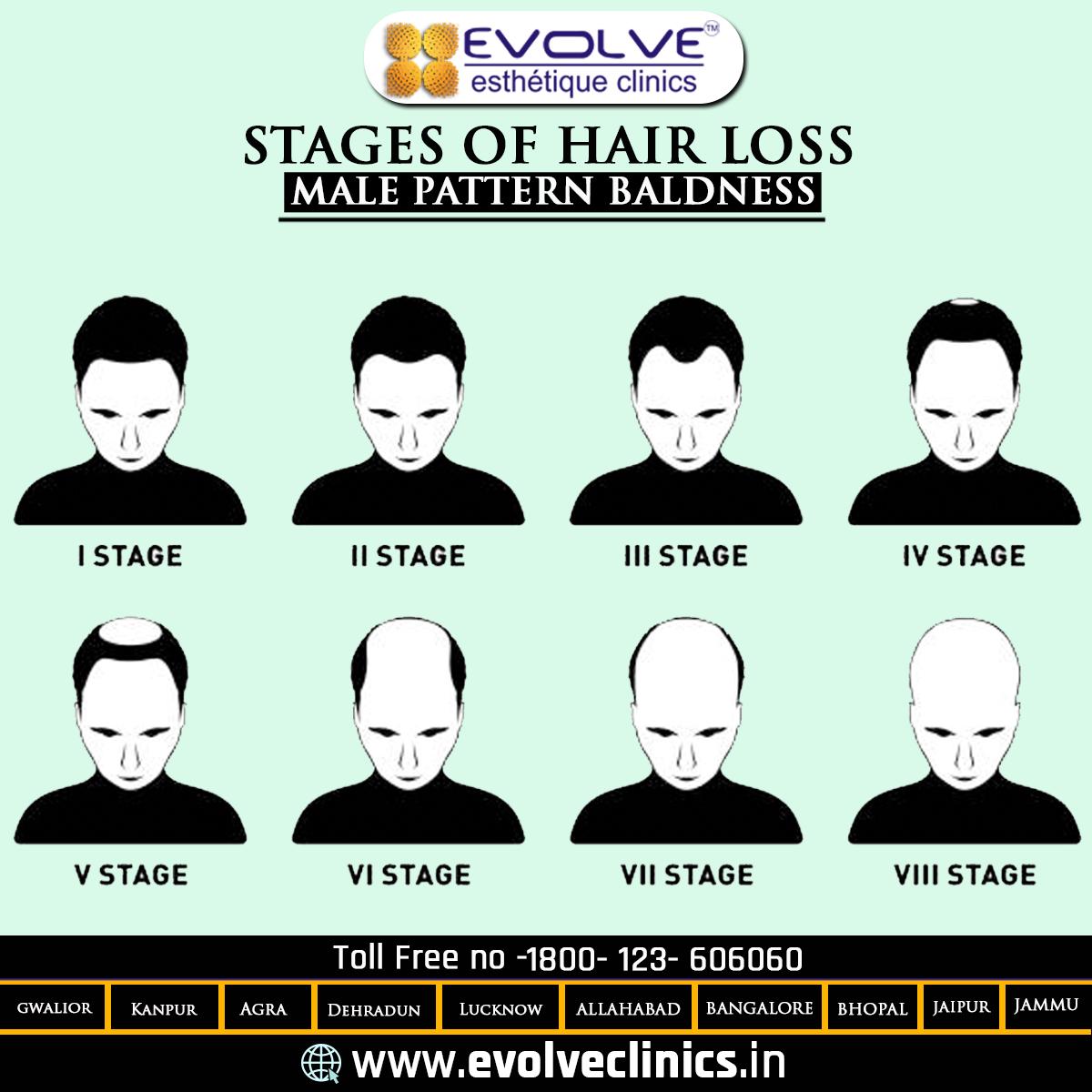Worlds Best Hair Transplant Clinic in Gurgaon  Eugenix  Hair transplant Hair  transplant procedure Hair science