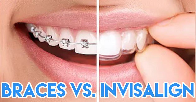 algosoftapps's tweet image. #BracesRX app for people looking to evaluate their Invisalign eligibility and consulting lnkd.in/fNJB8vW . Developed and designed by
#algosoftappstechnologies on #iosplatform #iosdevelopment #iosapp. #bestapps #development #company in #India