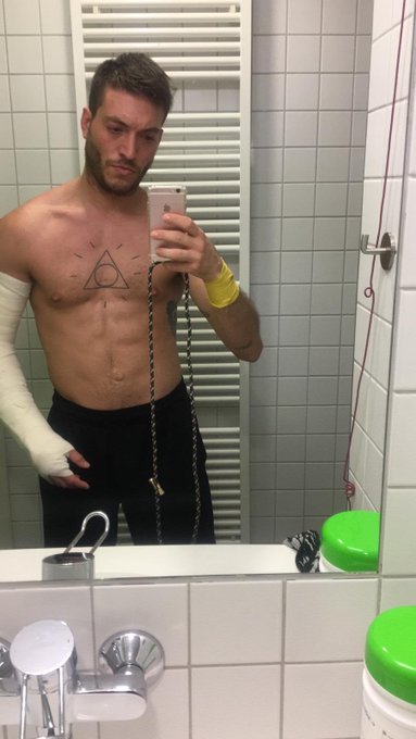 1 pic. I broke my fucking arm ? #brokenarm https://t.co/rmfqVdmmZS