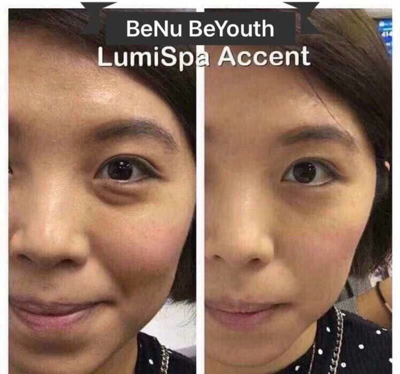 SallyHandMakeS1's tweet image. LumiSpa除咗洗面之外，換個導頭就可以做眼部護理耶~
#LumiSpaAccent 
#去眼袋神器 
#減淡黑眼圈 
#眼角細紋
#金漁眼
#暗沉掰掰