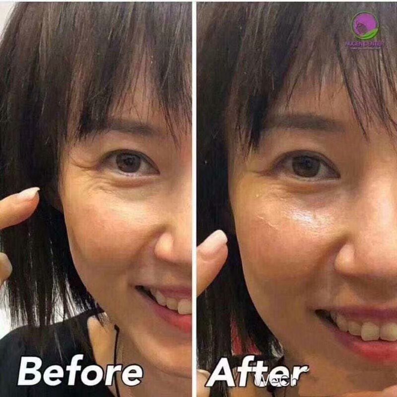 SallyHandMakeS1's tweet image. LumiSpa除咗洗面之外，換個導頭就可以做眼部護理耶~
#LumiSpaAccent 
#去眼袋神器 
#減淡黑眼圈 
#眼角細紋
#金漁眼
#暗沉掰掰