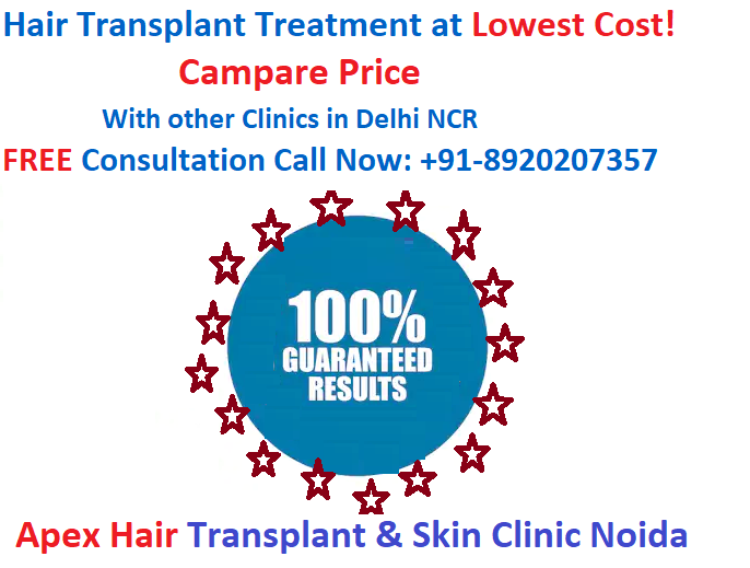 Apex Hair Transplant & Skin Clinic on Twitter: Apex Hair Transplant & Skin Clinic on Twitter: